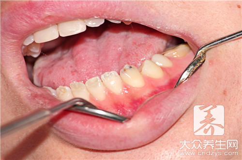 拔牙一周了有个牙洞正常吗