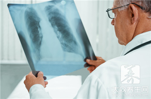 肺癌早期症状