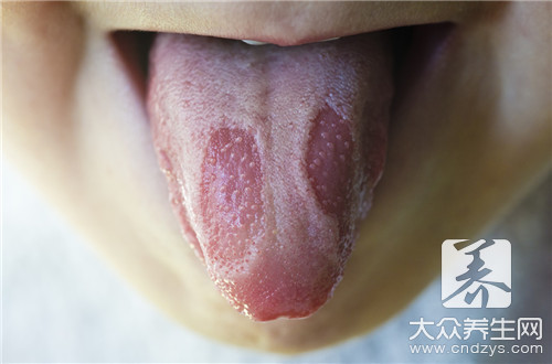 肠胃炎舌头