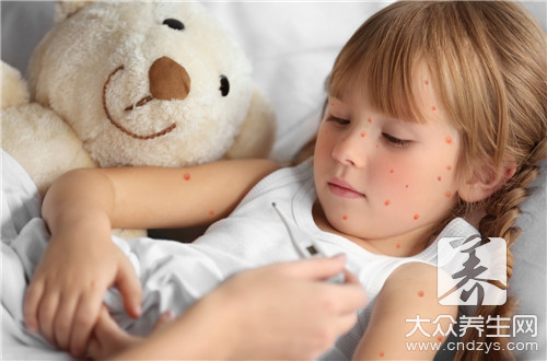 小儿荨麻疹如何治疗