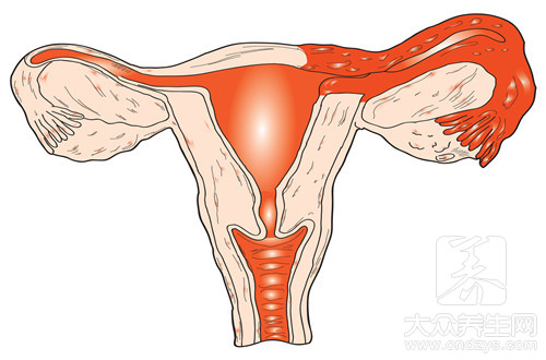 卵巢囊肿影响来月经吗