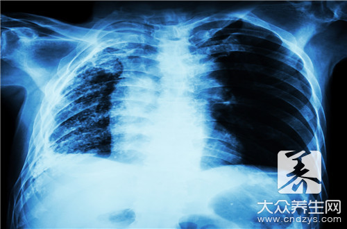 肺上斑点影是什么原因