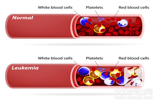 正常血氧是多少_血氧浓度正常值