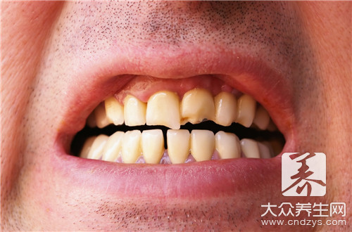 牙齿有横向裂缝是怎么回事？