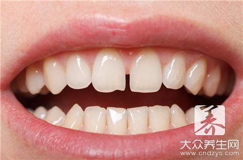 牙齿矫正的原理是什么