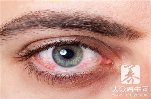 角膜红血丝用什么眼药水