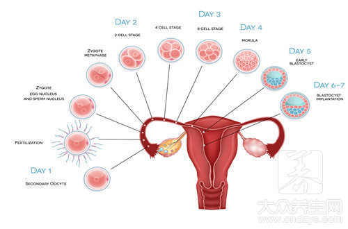 卵巢癌大便有什么症状
