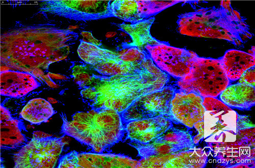 胶质母细胞瘤会遗传吗