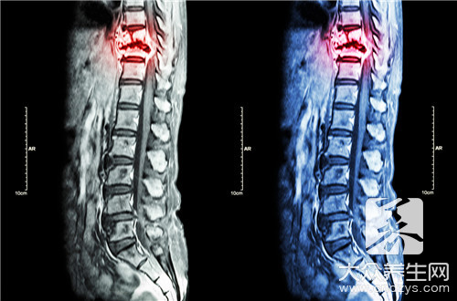 脊柱骶尾部是哪个部位
