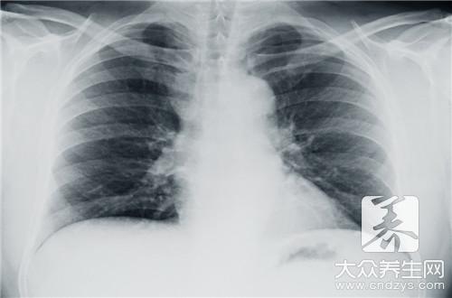 胸腔闭式引流管护理方法有哪些?