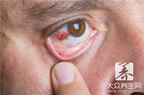 眼睛眼角疼是怎么回事，几种常见的原因