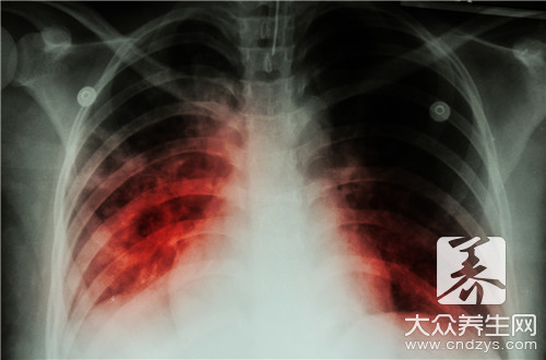 肺部有黑点是什么病症
