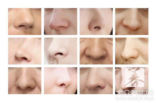 鼻子形状分哪几种