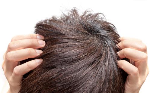 为何自己的白头发比别人来得快 预防白发勤于梳头