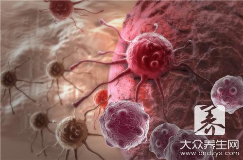 鳞状细胞癌抗原高引起炎症要注意什么？